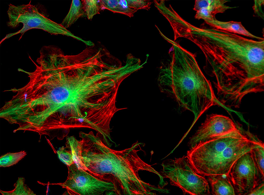 fluorescent cell imaging