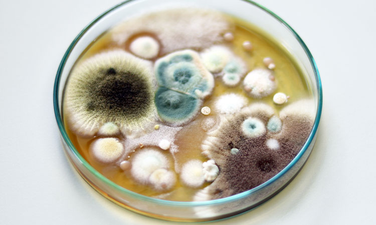 fungus in petri dish