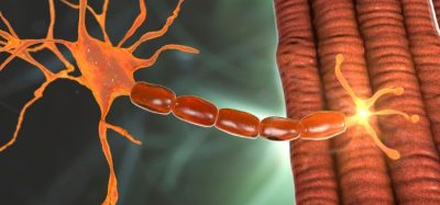 Elevidys gene therapy approved for Duchenne muscular dystrophy
