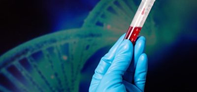First gene therapy approved for Haemophilia A