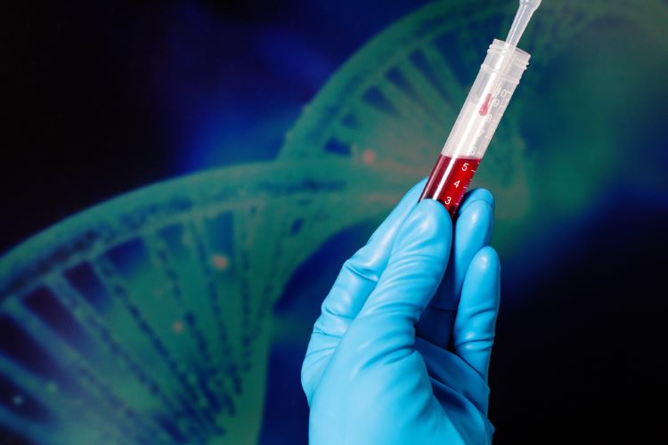 First gene therapy approved for Haemophilia A