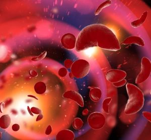 Could novel gene therapy treat sickle cell disease?