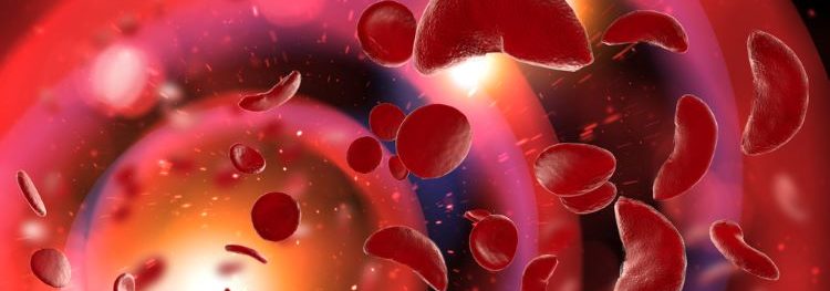 Could novel gene therapy treat sickle cell disease?