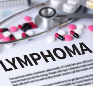 NICE recommends Roche biologic glofitamab for lymphoma