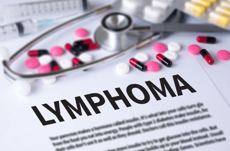 NICE recommends Roche biologic glofitamab for lymphoma