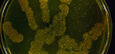 Bacterial on a petri dish growing in the shape of a hand print