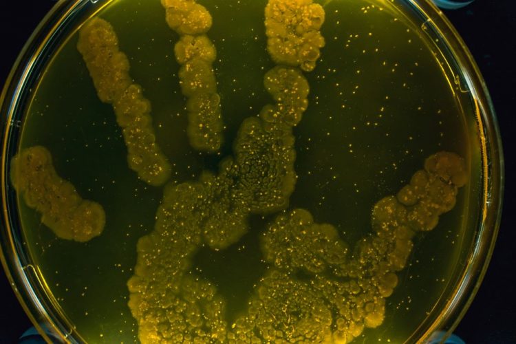 Bacterial on a petri dish growing in the shape of a hand print