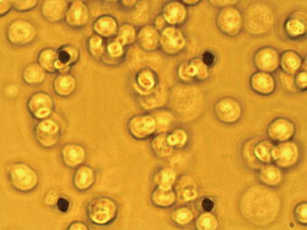 Figure 3a: Population patch clamp (PPC) recording. A IonWorks Quattro PPC planar patch plate – 64 apertures are clearly visible as an 8 x 8 array.