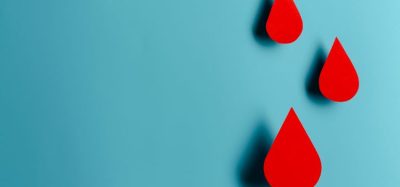 CHMP adopts positive opinion for haemophilia B gene therapy etranacogene dezaparvovec
