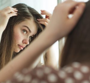 Woman with hair loss