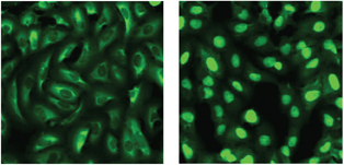 Figure 1: Osteosarcoma cells stably transfected with FOXO3a-GFP. After inhibitor treatment the FOXO3a-GFP translocates from the cytoplasm (A: DMSO control) to the nucleus (B: LY294002, PI3K inhibitor). By analysing the fluorescence within the nucleus and the cytoplasm a quantitative measure of inhibitor activity can be derived.