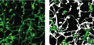 Figure 4: Rat cerebellar granule neurons labeled with anti ‚-tubulin III antibody (green) and nuclear label DRAQ5™ (red). The image analysis software is able to analyse several read out parameters e.g. cell number, neuronal number, number, length and area of neurites.