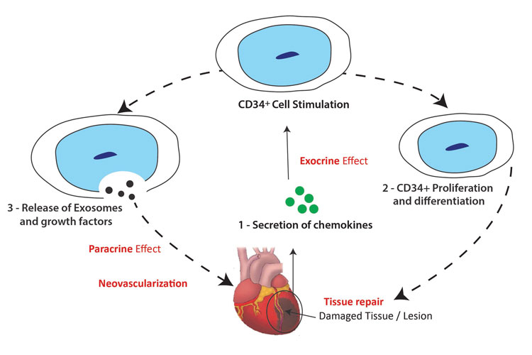 Innovative approach brings cell-reprogramming therapy for heart failure  closer to reality