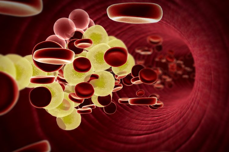 3D illustration of red blood cells and yellow triglyceride/fat globules in a blood vessel - idea of hypercholesterolaemia or hypertriglyceridemia