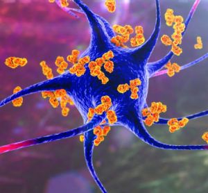 3D illustration of orange antibodies surrounding a blue and purple neuron
