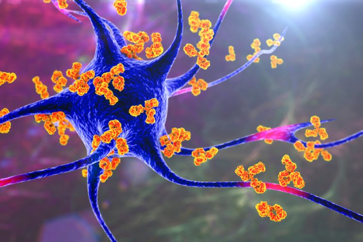 3D illustration of orange antibodies surrounding a blue and purple neuron