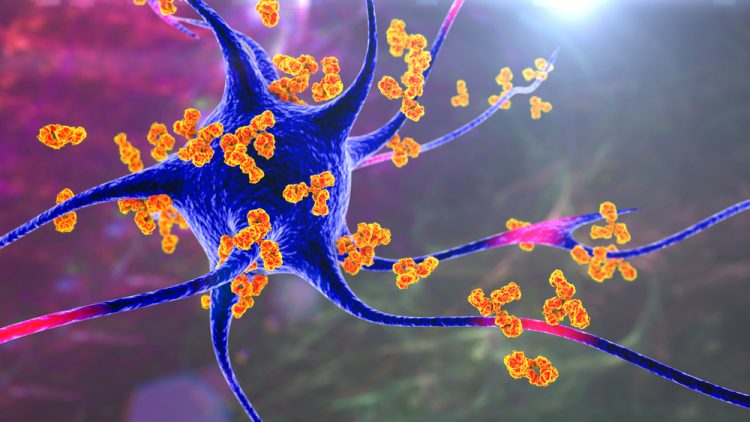 3D illustration of orange antibodies surrounding a blue and purple neuron