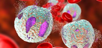 Immunotherapy to become standard treatment for infants with ALL