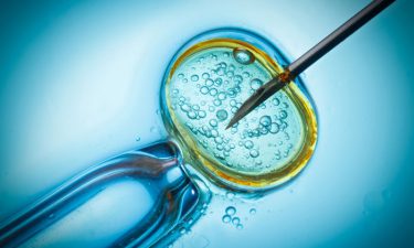 assisted reproductive treatment (ART)