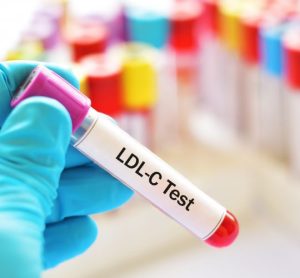 Novartis siRNA therapy inclisiran shows long-term potential in lowering LDL-C