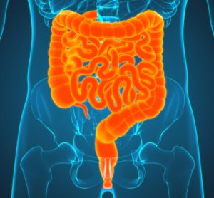 3D illustration of the small and large intestines (highlighted in orange) within the human abdomen - idea of inflammatory bowel diseases such as Crohn's disease or Ulcerative Colitis