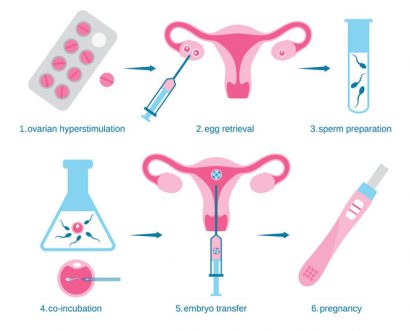 ivf-infographic