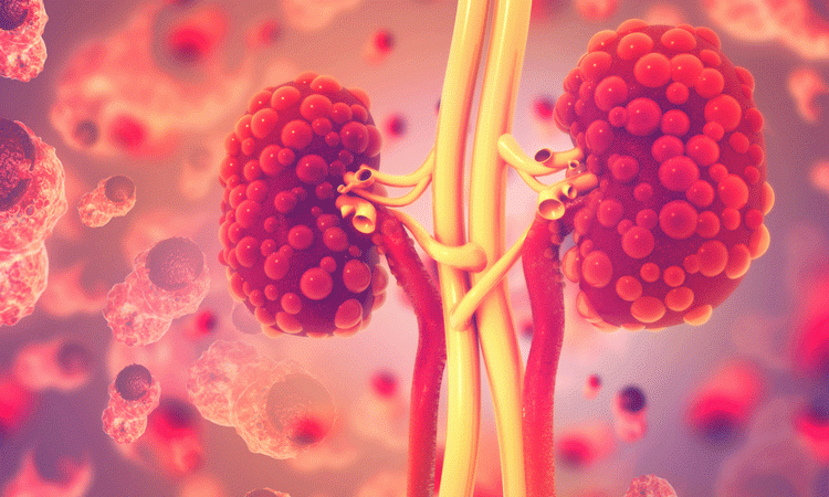 direct oral anticoagulants kidney disease