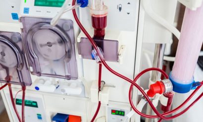 kidney-dialysis-machine