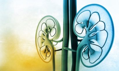 kidney-failure
