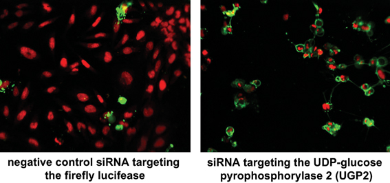 Fig. 1 A high-content siRNA screen was performed to analyse which genes are essential to keep unaltered cell viability. 48 or 96 hours after siRNA transfection, cells were stained with Draq5 and Annexin V without prior fixation. Nuclei appear in red, cells that expose phosphatidylserine (PS) to the outside cell surface are marked in green. The depletion of the UDP-glucose pyrophosphorylase 2 by a targeting siRNA on the right exhibited strong apoptotic phenotypes compared to the negative control treated cells on the left. Multiparametric analysis can be performed by automated image analysis to classify and quantify the various nuclear morphology changes and to measure the presentation of PS on the outside membrane surface. The data contributed to a publication29.