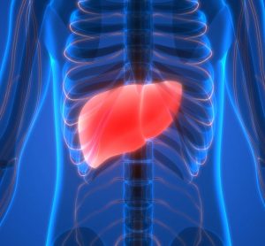 liver cirrhosis