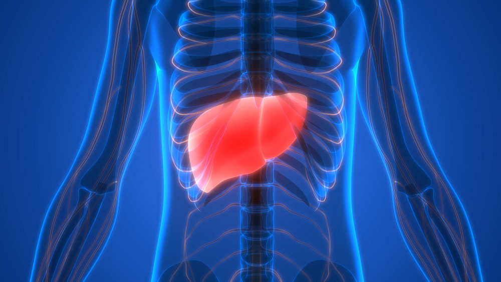 liver cirrhosis