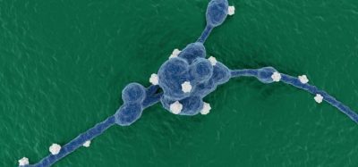 Treatment shows strong potential for ALK-driven neuroblastoma - lorlatinib