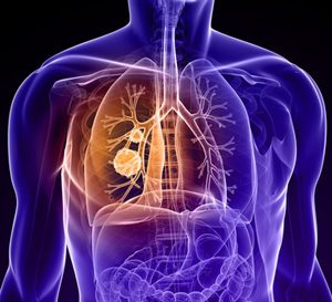 PharmaMar initiates a phase III ATLANTIS study in patients with small cell lung cancer