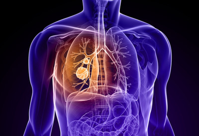 PharmaMar initiates a phase III ATLANTIS study in patients with small cell lung cancer