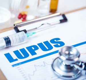 concept of lupus treatment or drug development - word lupus typed on page surrounded by colourful pills, a syringe and stethoscope