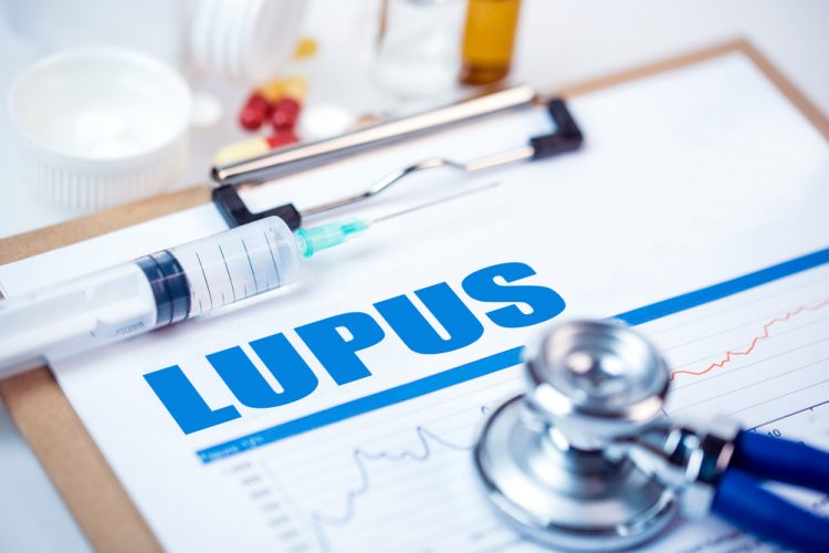 concept of lupus treatment or drug development - word lupus typed on page surrounded by colourful pills, a syringe and stethoscope