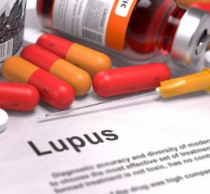 Lupus treatment