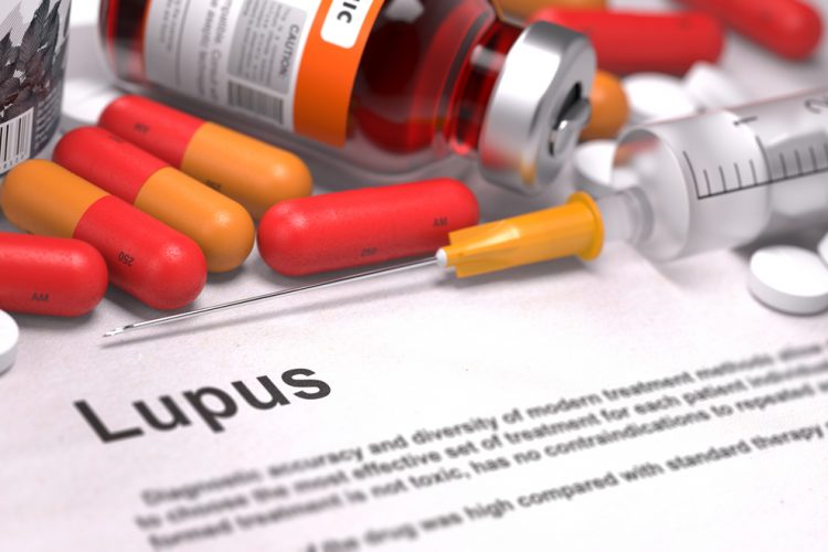 Lupus treatment