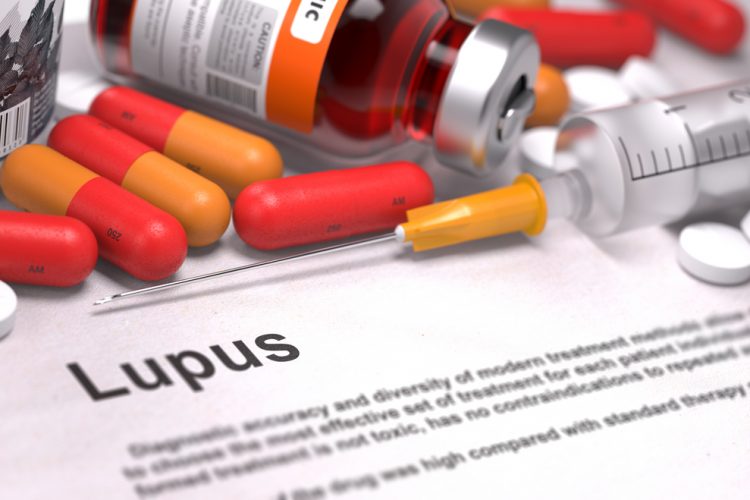 lupus medications