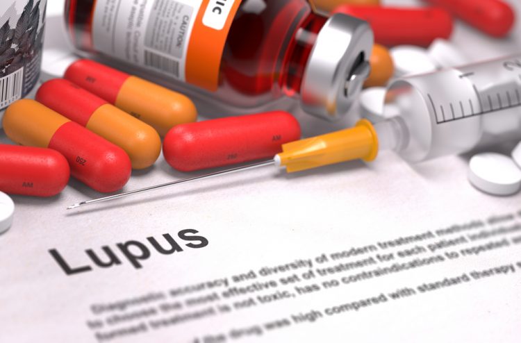 Lupus treatment