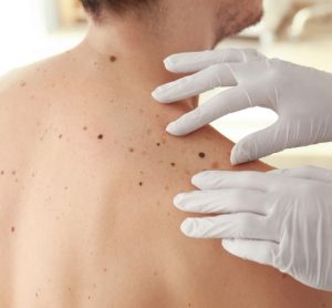 Immunotherapy combo could overcome melanoma anti-PD-1 resistance