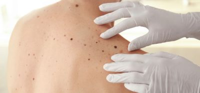 Immunotherapy combo could overcome melanoma anti-PD-1 resistance
