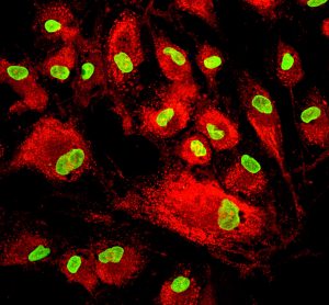 Mesenchymal stem cells labeled with fluorescent molecules.