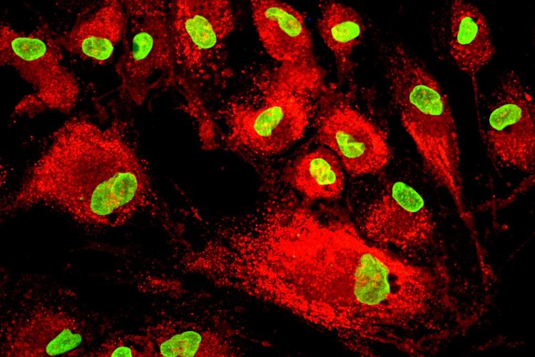 Mesenchymal stem cells labeled with fluorescent molecules.