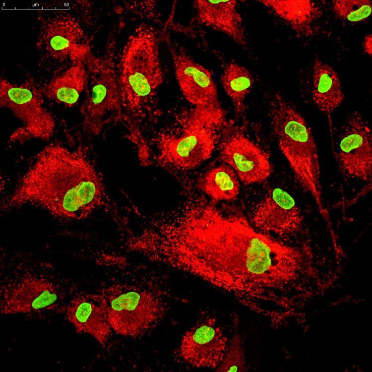 Mesenchymal stem cells labeled with fluorescent molecules.