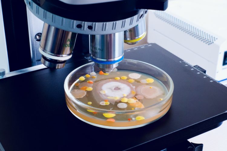 A petri dish with multi-colored colonies of bacteria lies on a microscope slide.