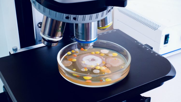 A petri dish with multi-colored colonies of bacteria lies on a microscope slide.