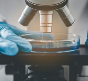 Close up of a researcher's gloved hands holding a petri dish under a microscope - idea of microbial detection through culture methods