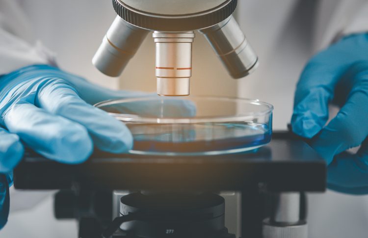 Close up of a researcher's gloved hands holding a petri dish under a microscope - idea of microbial detection through culture methods